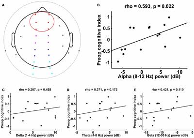 Intraoperative Frontal Alpha-Band Power Correlates with Preoperative Neurocognitive Function in Older Adults